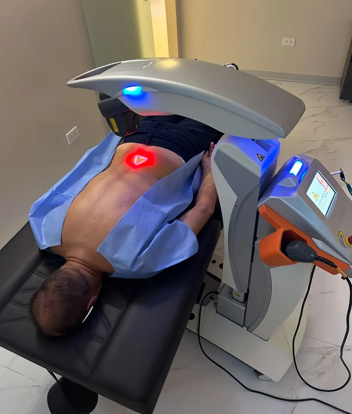 Láser robótico M8 aplicando tratamiento sobre la zona dorsal de una paciente en LIFE